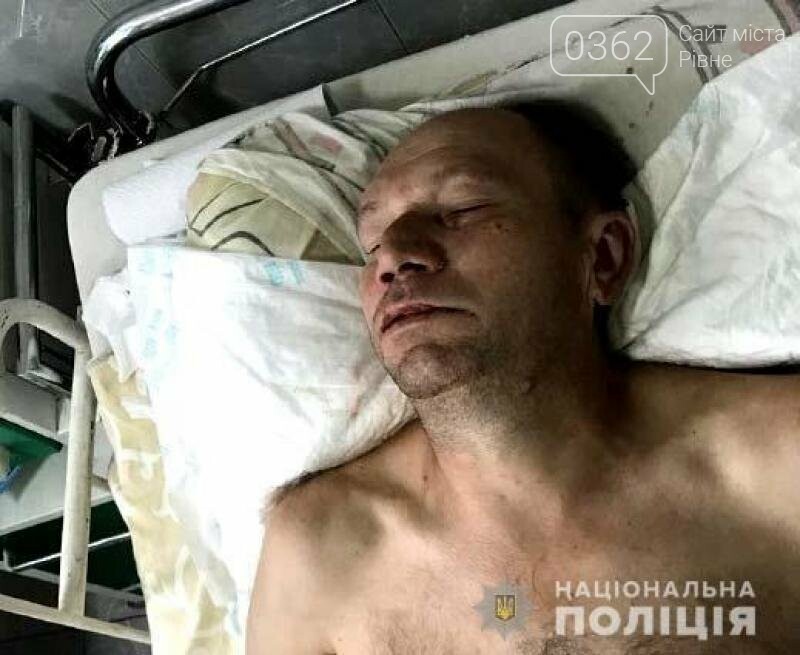 Чоловік, якого знайшли травмованим на Міцкевича у Рівному,..., фото-1 Чоловік, якого знайшли травмованим на Міцкевича у Рівному, помер (ФОТО 18+), фото-1
