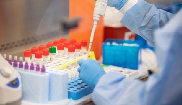 На Рівненщині оновлюють медичні лабораторії