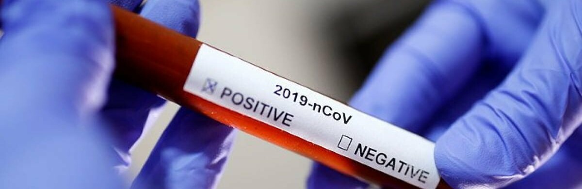 Від коронавірусу померла ще одна людина на Рівненщині
